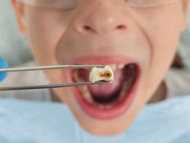 Best Emergency Treatment for Toothache in Newport East, RI