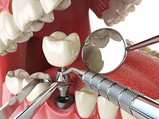 Reliable RI Emergency Dentist Solutions